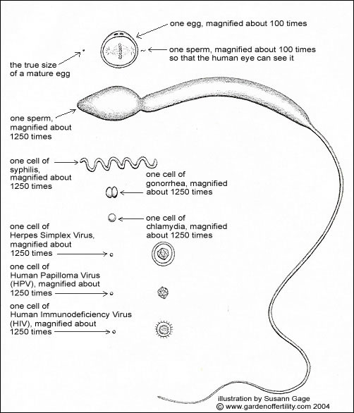 Drawing of relative sizes of egg, sperm, syphilis, gonnorhea, chlamydia, Herpes Simplex, Human Papilloma Virus (HPV), Human Immuno Deficiency Virus (HIV)